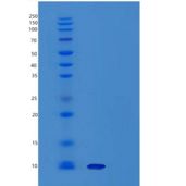 小鼠子宫珠蛋白/ SCGB1A1重组蛋白His tag