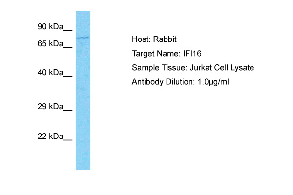 IFI16 Antibody - middle region (ARP72649_P050) in Human Jurkat using Western Blot