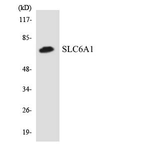 SLC6A1 Antibody (OAAF07144) in HeLa using Western blot.