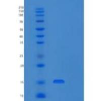 人酸性成纤维细胞生长因子(FGF1)重组蛋白Phe16-Asp155