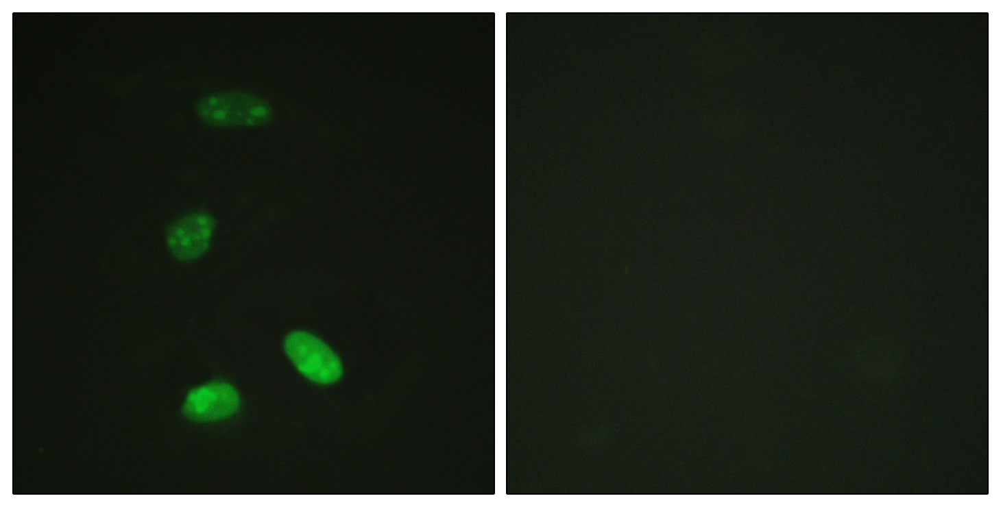 MYB Antibody (OAAF00793) in HeLa using Immunofluorescence.
