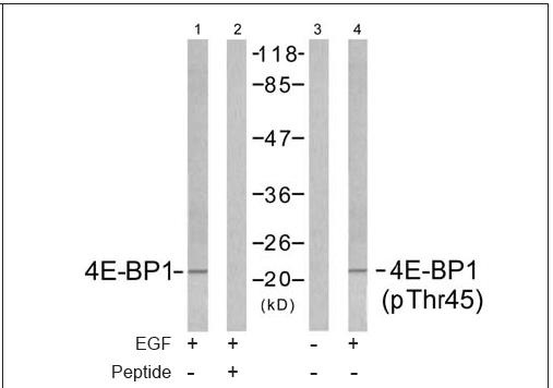 4E-BP1 (Ab-45) Antibody (OAEC00557) in MDA-MB-435 using Western Blot