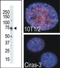 RSKB (MSK2) Antibody (C-term R321) (OAAB16739) in placenta tissue using Western Blot