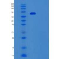 人CD30配体(CD30L)重组蛋白C-Fc