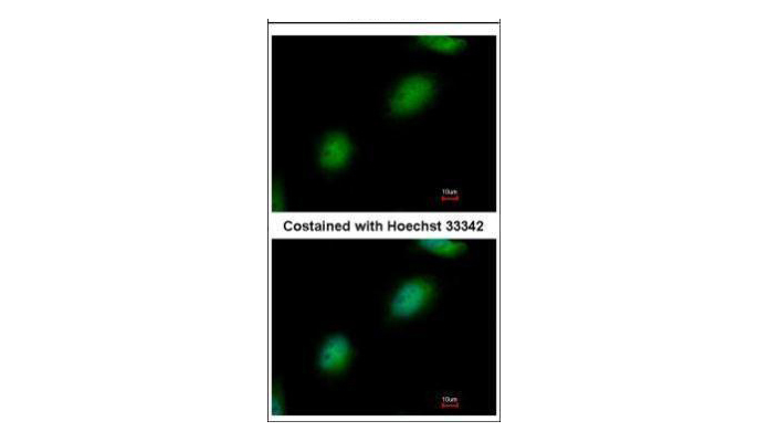 TPRKB antibody (OAGA00532) in HeLa using Immunofluorescence