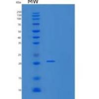 人室管膜蛋白相关蛋白1(EPDR1)重组蛋白C-6His