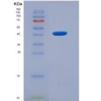 人双调蛋白(AREG)重组蛋白