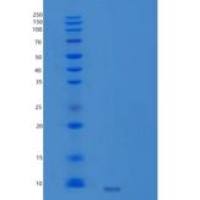 小鼠胰岛素样生长因子1(IGF1)重组蛋白