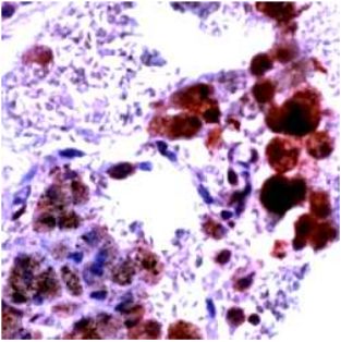 Rabbit Anti-iNOS Polyclonal Antibody(OAAI00215) in Human Lung tissue using Immunohistochemistry.