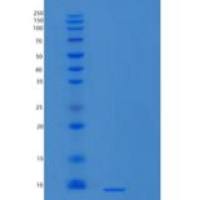 人LR3胰岛素样生长因子I/LR3-IGF-1重组蛋白MG