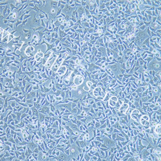 KYSE-180 人食管鳞状细胞癌细胞/STR鉴定/镜像绮点（Cellverse）