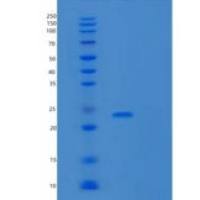 人扭转原肠胚形成同源物1(TWSG1)重组蛋白C-6His