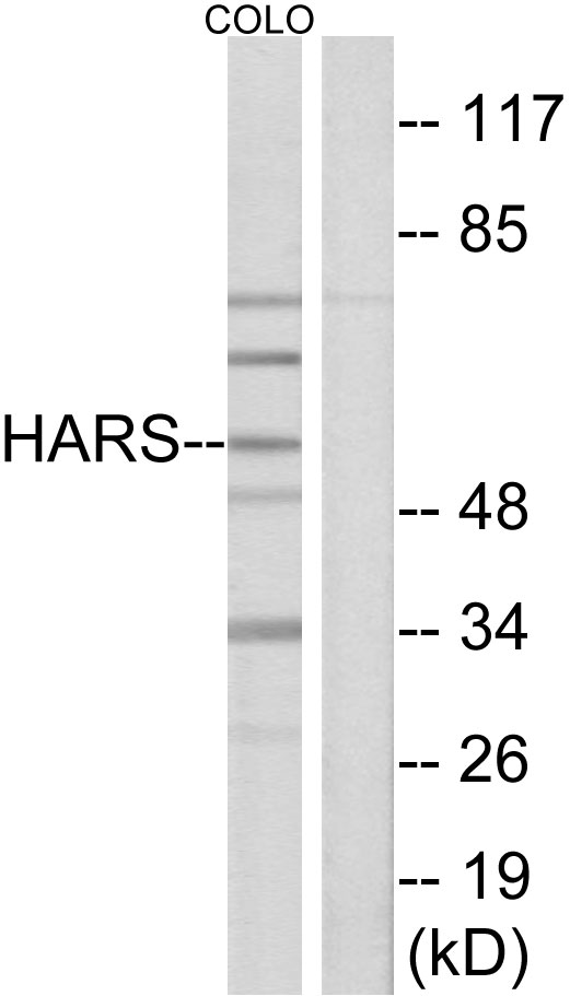 HARS Antibody (OAAF02138) in COLO using Western blot.