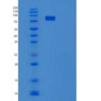 人白细胞介素-12受体亚单位β-1重组蛋白