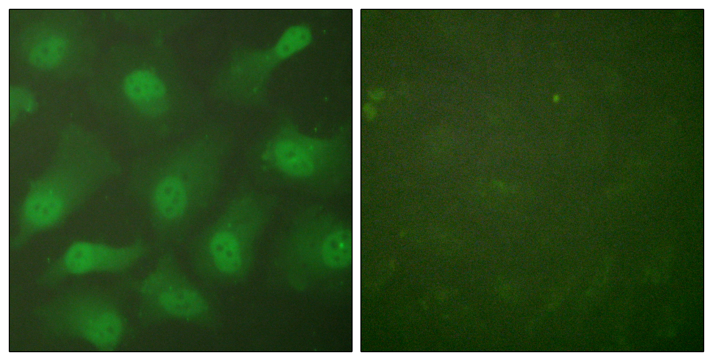 CSE1L Antibody (OAAF01749) in HeLa using Immunofluorescence.