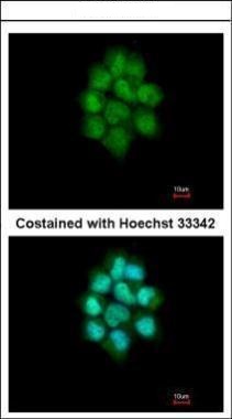 CCND3 Antibody (OAGA01626) in Paraformaldehyde-fixed A431 using Immunofluorescence