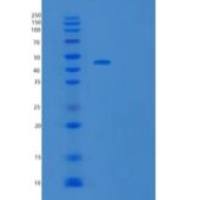 人肿瘤坏死因子受体超家族成员21(TNFRSF21)重组蛋白C-Fc