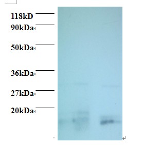 Rabbit anti-human Charged multivesicular body protein 2a (OACA01167) in EC109 , 293T using Western Blot