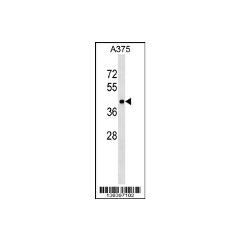 METAP1 antibody - center region (OAAB12584) in A375 using Western Blot