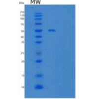 人t细胞免疫球蛋白和粘蛋白结构域-3/TIM-3/HAVCR2重组蛋白
