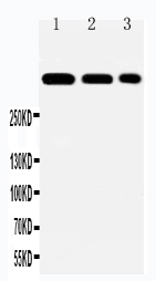 LAMA2 Antibody - N-terminal region (OABB01322) in HELA Cell Lysate, A549 Cell Lysate, PANC Cell Lysate using Western Blot