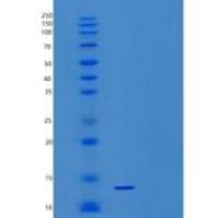 人血清淀粉样蛋白A1/SAA重组蛋白N-6His