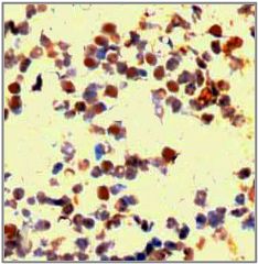 Rabbit Anti-P53 Antibody (Phospho-Ser15)(OAAI00414) in UV treated Hela using Immunohistochemistry.