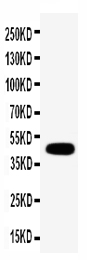 GJC1 Antibody - C-terminal region (OABB01370) in MCF-7 Cell Lysate using Western Blot
