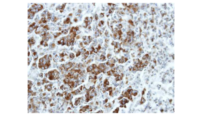 FAF2 antibody (OAGA00625) in CL1-5 Xenograft using Immunohistochemistry