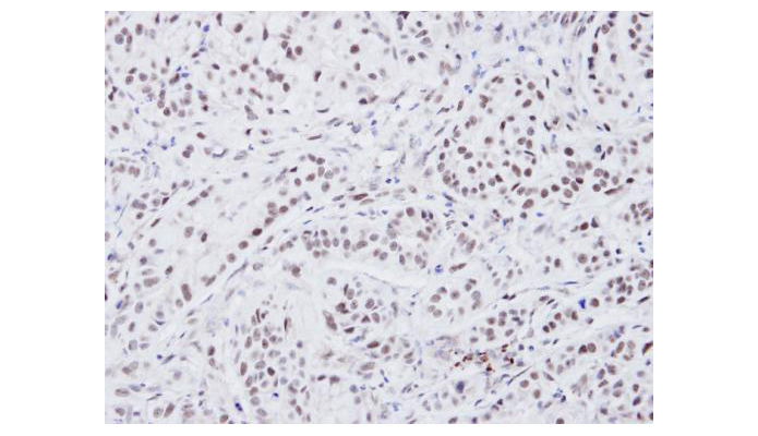 ATRX antibody (OAGA00086) in A549 Xenograft using Immunohistochemistry