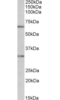 Goat anti-Caspase 3 middle region Antibody (OAEB02614) in MOLT4cells using Western Blot