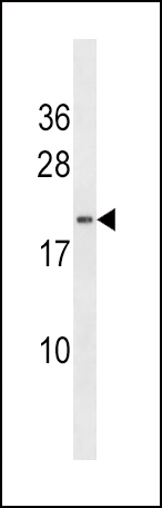 HAND2 antibody - C - terminal region (OAAB16477) in NCI-H460 using Western Blot