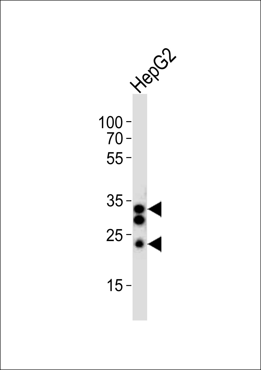 SULT1A1 Antibody - C-terminal region (OAAB18983) in HepG2 cell line using Western Blot