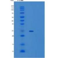 小鼠血清淀粉样蛋白P成分重组蛋白