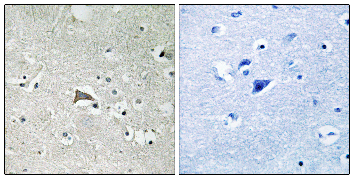 FLT1 Antibody (OAAF01565) in human brain tissue using Immunohistochemistry.