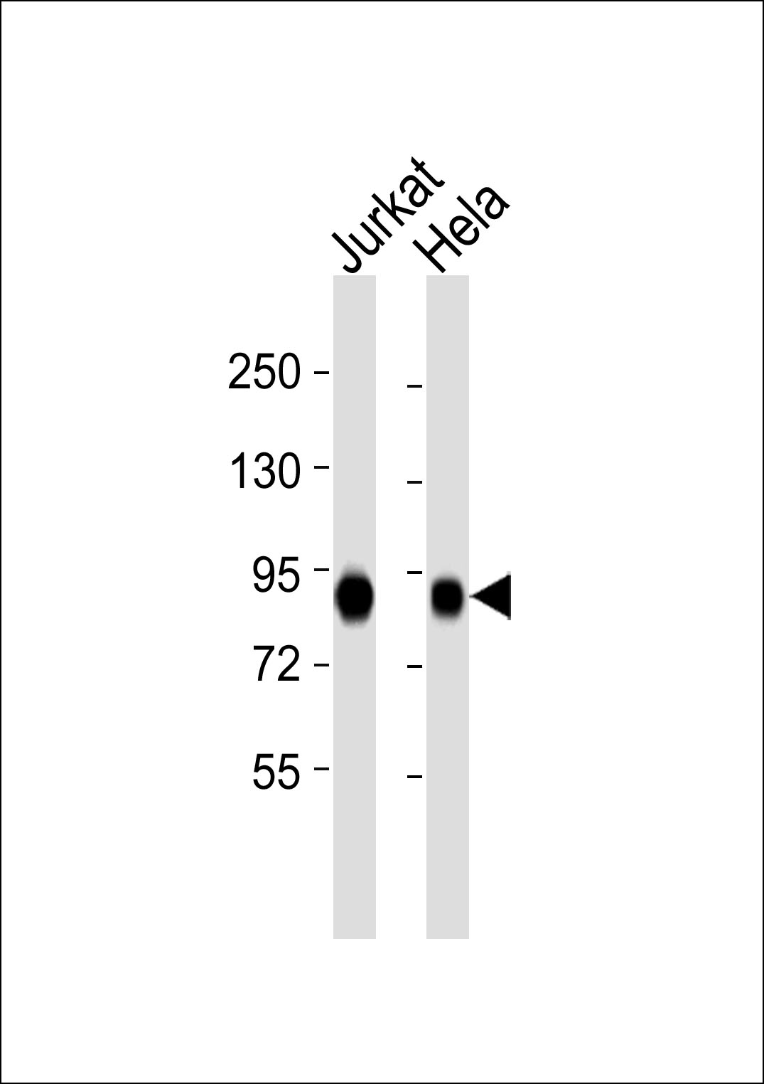 KAT7 Antibody (OAAB19707) in Jurkat whole cell lysates, Hela whole cell lysates using Western Blot