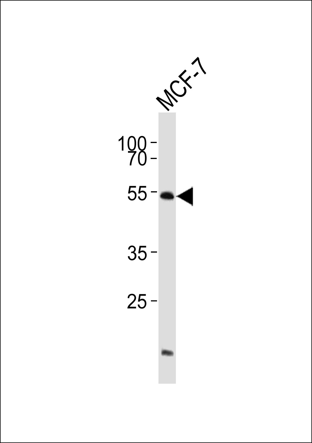 ADRA2B Antibody (OAAB18305) in MCF-7 cell line using Western Blot