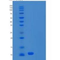 人S100钙结合蛋白A8(S100A8)重组蛋白C-6His