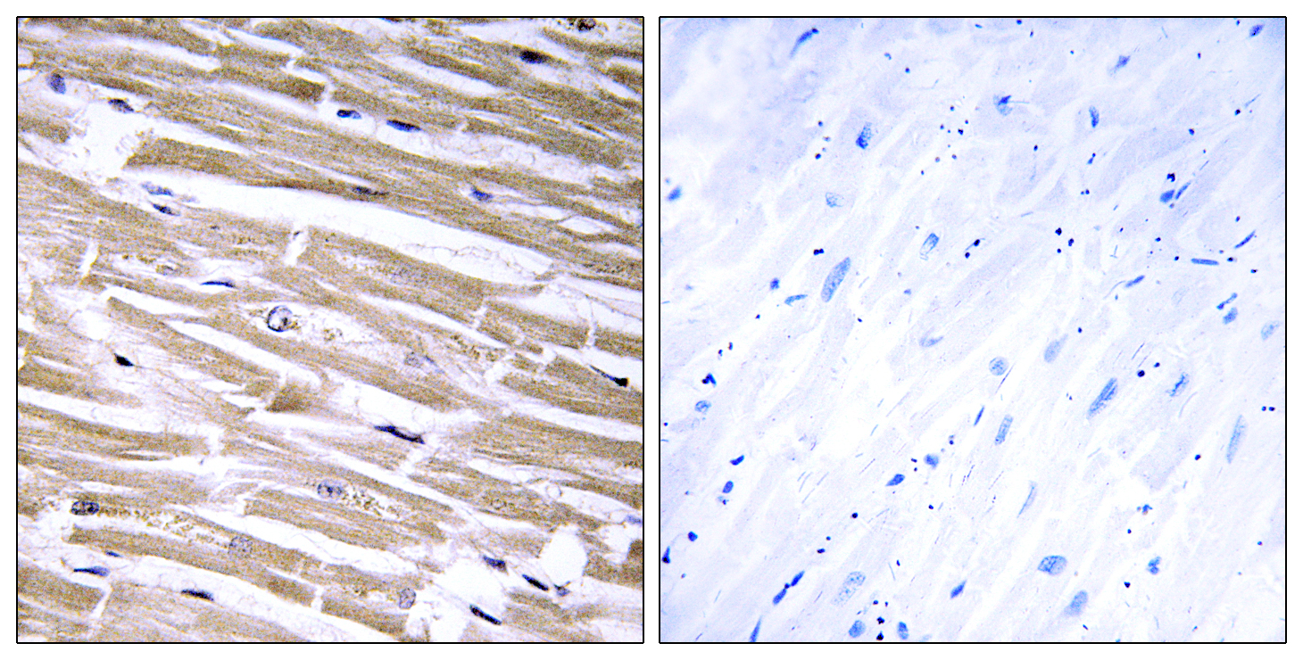 B3GALT2 Antibody (OAAF03364) in human heart tissue using Immunohistochemistry.