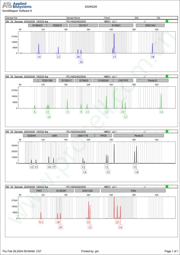 U-2932(人弥漫大B淋巴瘤细胞)