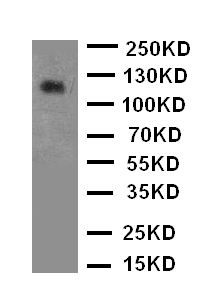 NTRK2 Antibody - N-terminal region (OABB01312) in Rat Brain Tissue Lysate using Western Blot