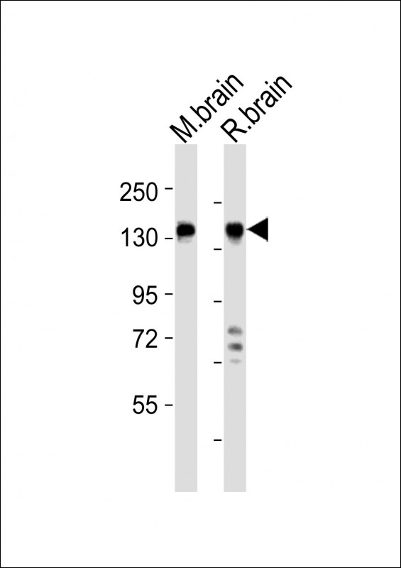 MAGI2 Antibody - C-terminal region (OAAB19203) in Mouse brain lysates, rat brain lysates using Western Blot