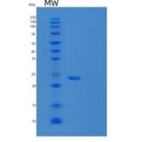 人肝细胞粘附分子/肝素钙重组蛋白C-6His