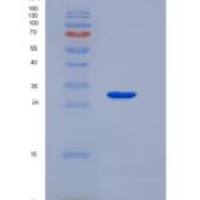 人神经生长因子(NGF)重组蛋白