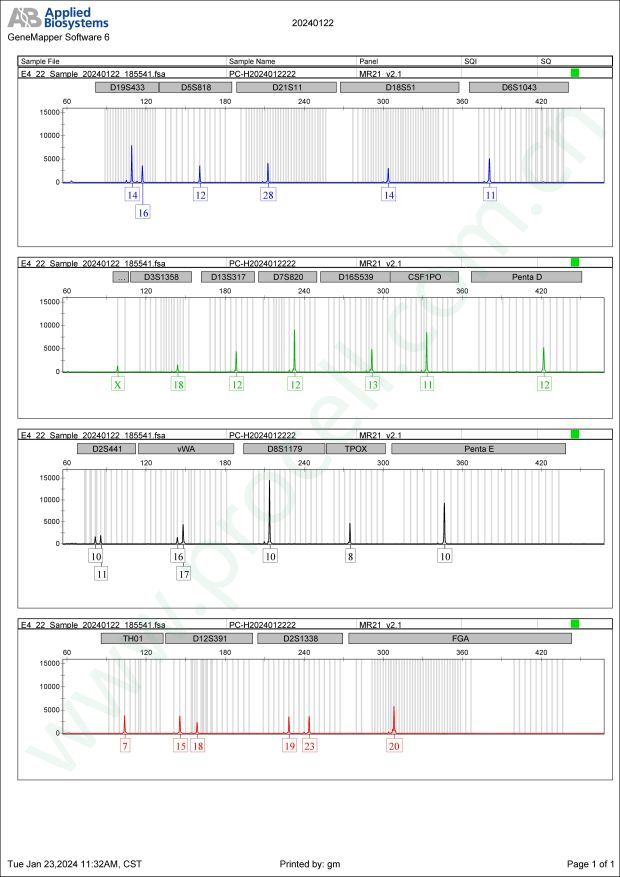OVCAR-8（人卵巢癌细胞）