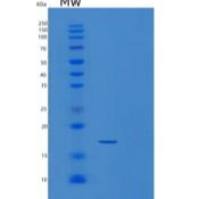 人胶质细胞成熟因子β(GMFb)重组蛋白C-6His