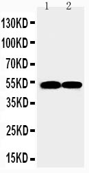 FLI1 Antibody - N-terminal region (OABB01342) in JURKAT Cell Lysate, RAJI Cell Lysate using Western Blot