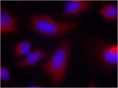 RPS6KB1 Antibody (OAEC00611) in HeLa using Immunofluorescence