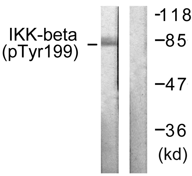 IKK-beta Antibody (Phospho-Tyr199) (OAAF07386) in HeLa using Western Blot