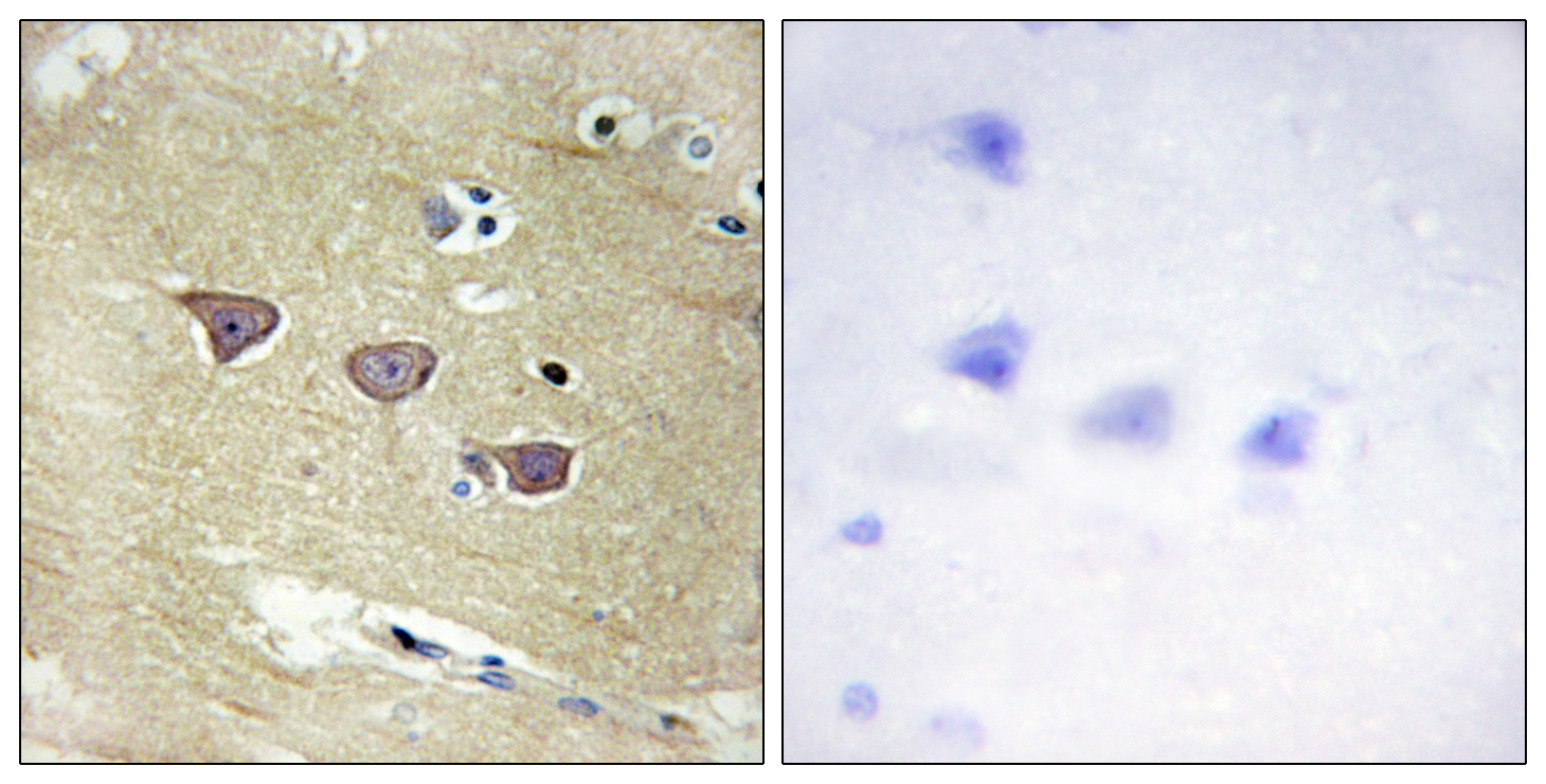 CAMKV Antibody (OAAF02547) in human brain tissue using Immunohistochemistry.